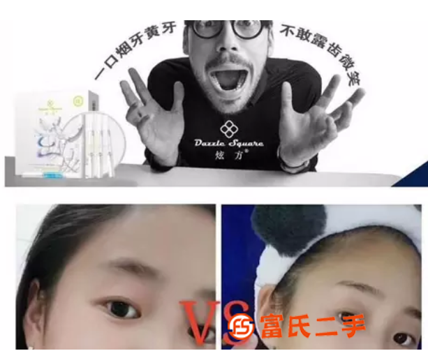 牙齿美白仪牌子好